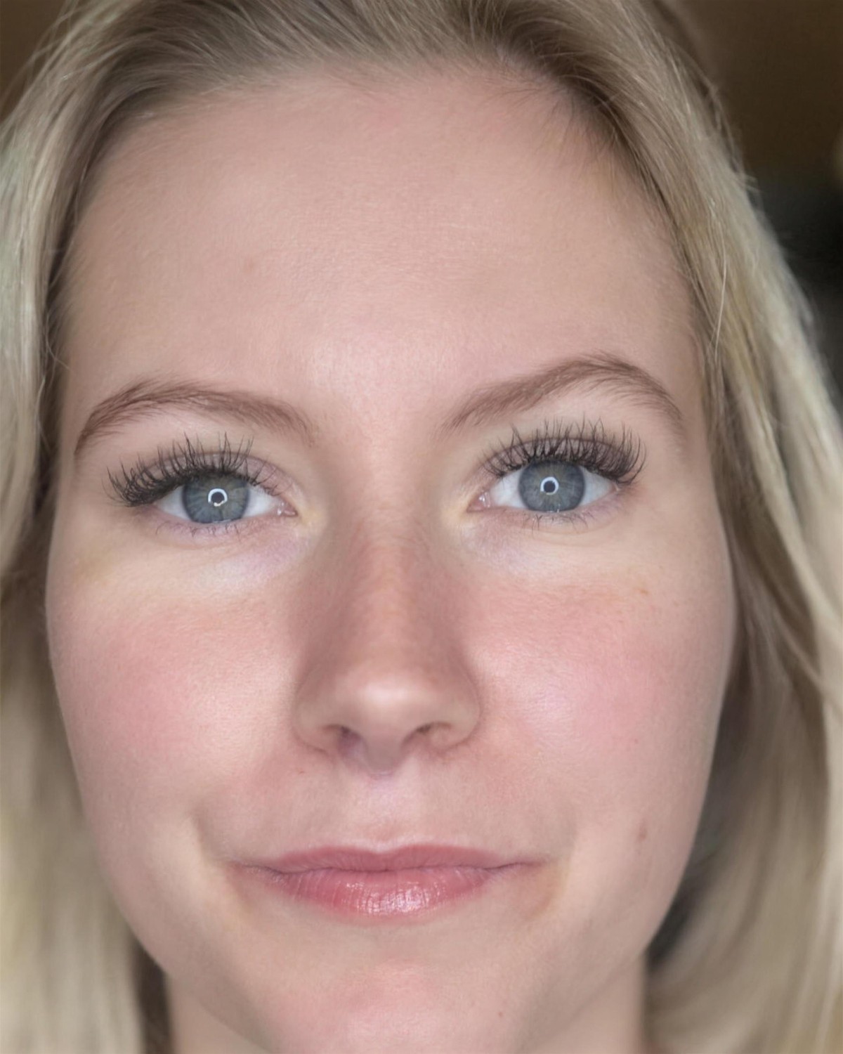 Bryn før behandling hos Fairbeauty