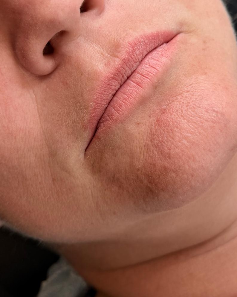 Læber før permanent makeup hos Fairbeauty i Silkeborg